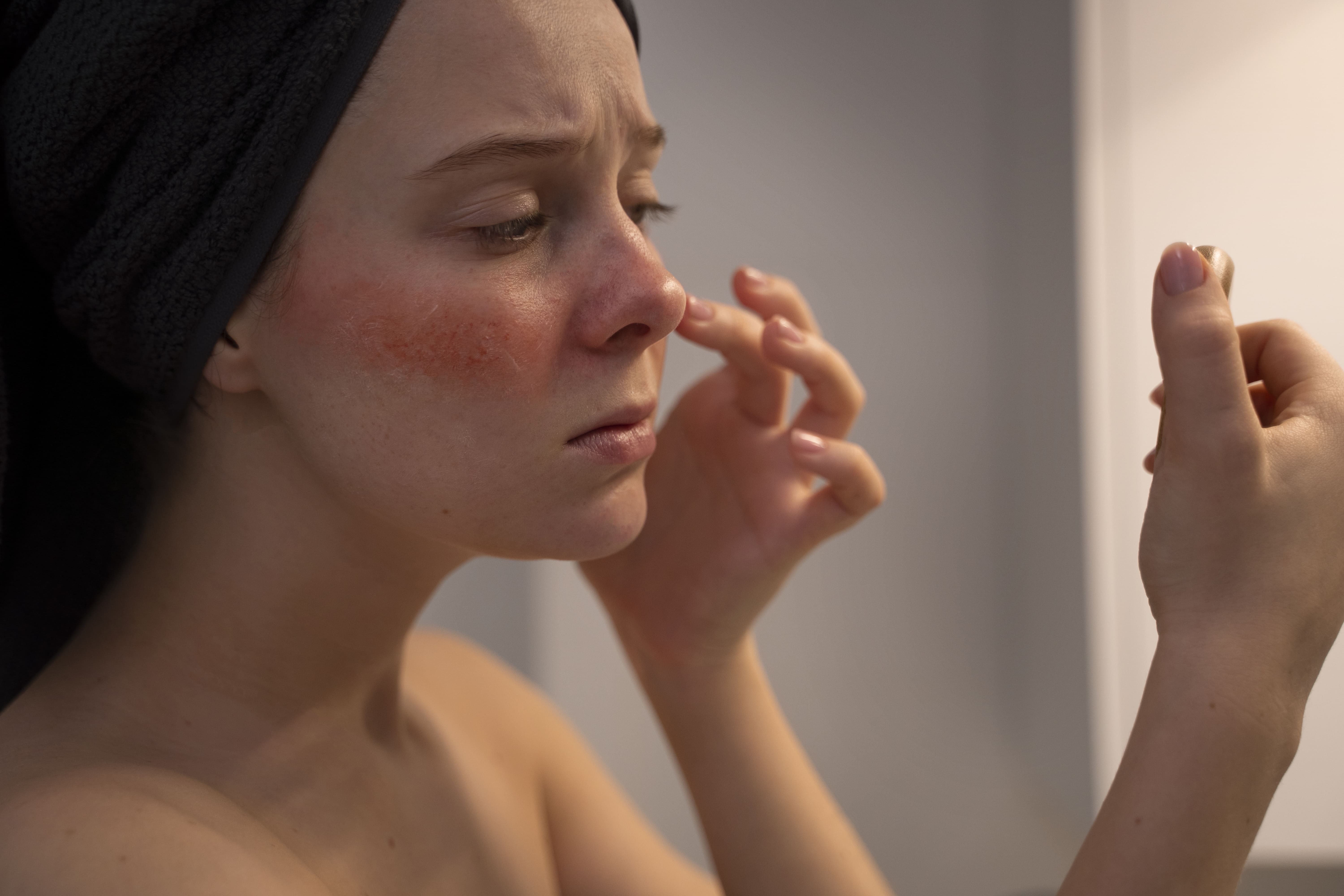 pelle sensibile esfoliazione eccessiva